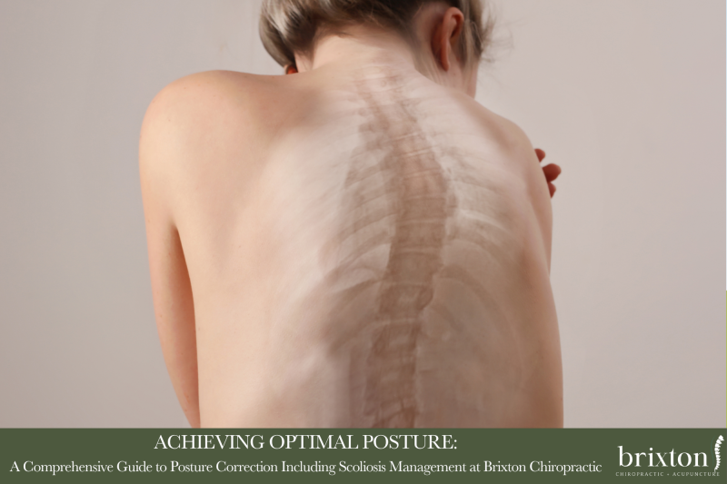 Achieving Optimal Posture A Comprehensive Guide to Posture Correction Including Scoliosis Management at Brixton Chiropractic Revised