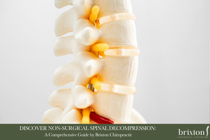 Discover Non-Surgical Spinal Decompression A Comprehensive Guide by Brixton Chiropractic in Oklahoma City Revised